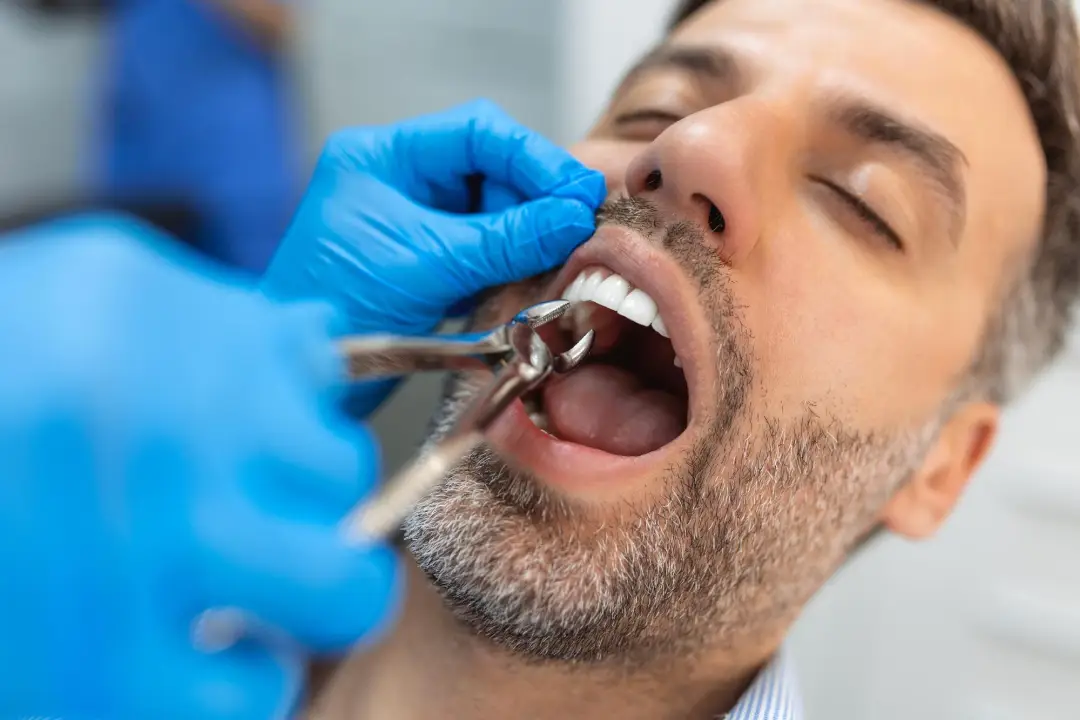 Tooth Extraction-Oral Surgery by Valley View Dental
